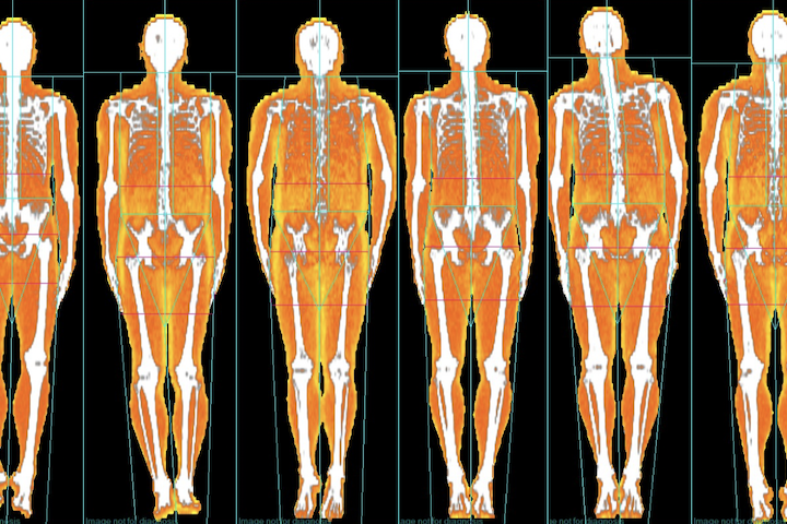 Ako si presne odmerať % tuku v telocvični?